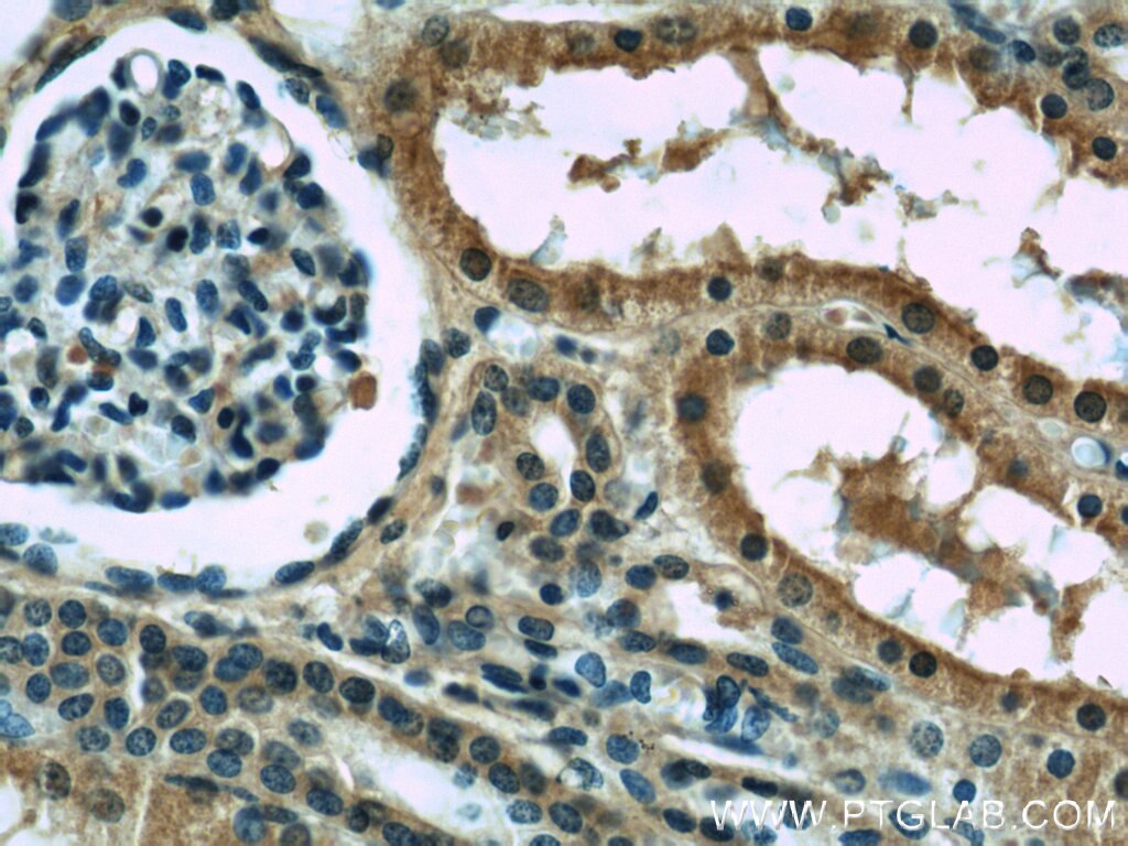 IHC staining of human kidney using 66092-1-Ig