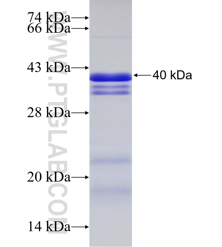 MLPH fusion protein Ag32931 SDS-PAGE