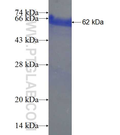 MLST8 fusion protein Ag2359 SDS-PAGE