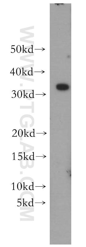 Western Blot (WB) analysis of mouse ovary tissue using MLX Polyclonal antibody (12042-1-AP)