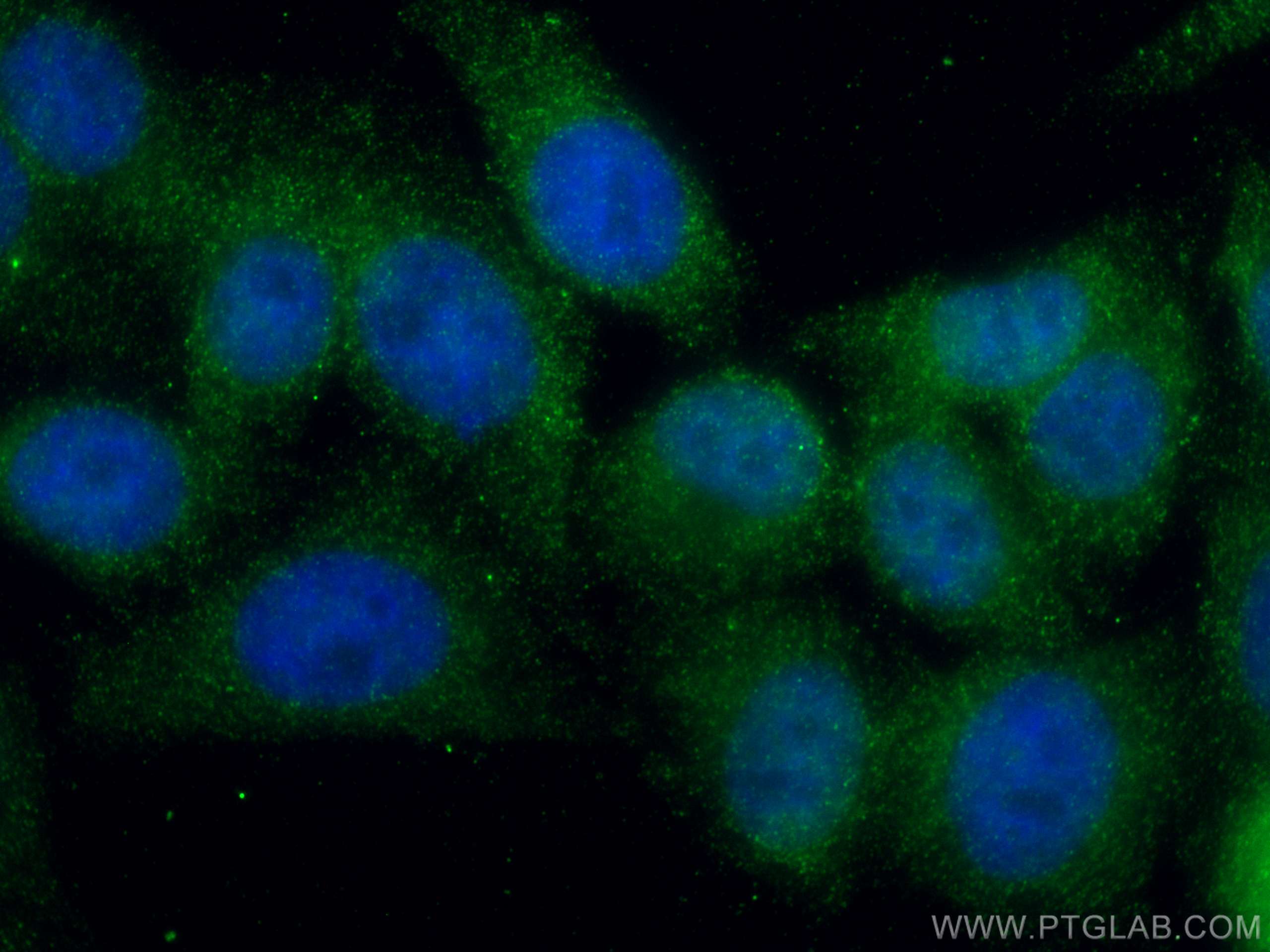 Immunofluorescence (IF) / fluorescent staining of HepG2 cells using MLX Monoclonal antibody (67042-1-Ig)