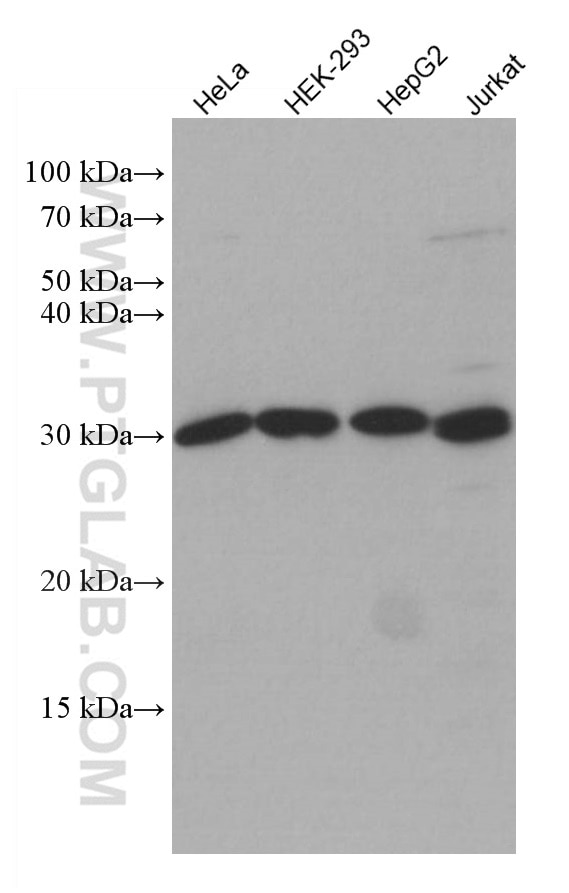 Western Blot (WB) analysis of various lysates using MLX Monoclonal antibody (67042-1-Ig)