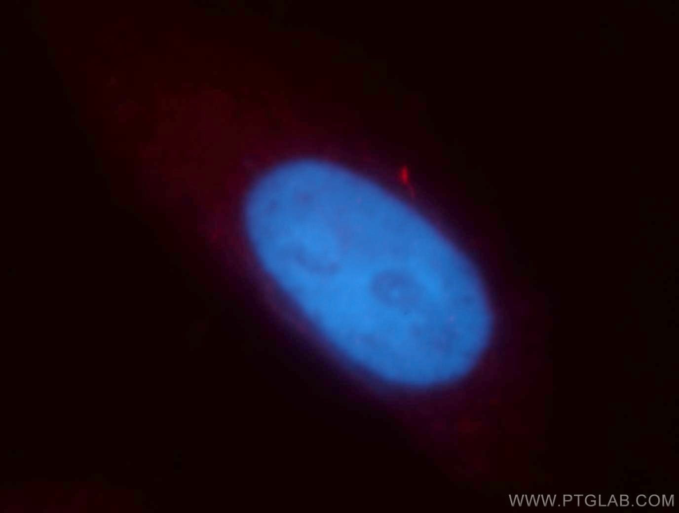 Immunofluorescence (IF) / fluorescent staining of HepG2 cells using MLXIP Polyclonal antibody (13614-1-AP)