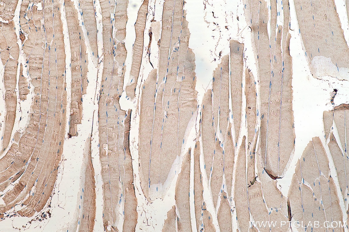 Immunohistochemistry (IHC) staining of mouse skeletal muscle tissue using MLXIP Polyclonal antibody (13614-1-AP)