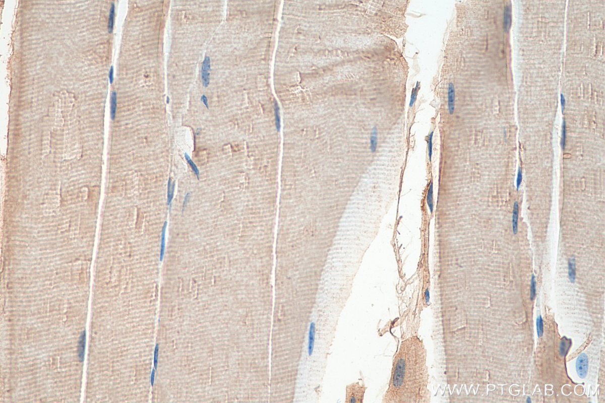 Immunohistochemistry (IHC) staining of mouse skeletal muscle tissue using MLXIP Polyclonal antibody (13614-1-AP)