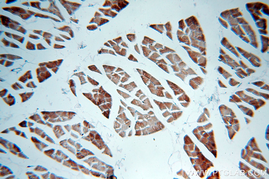 Immunohistochemistry (IHC) staining of human skeletal muscle tissue using MLXIP Polyclonal antibody (13614-1-AP)
