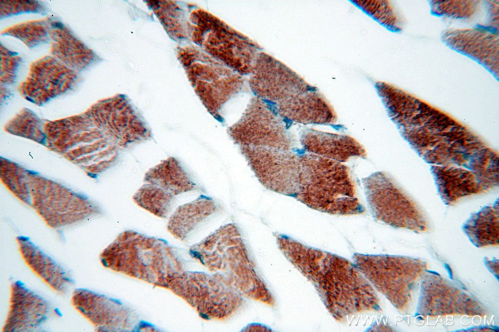 Immunohistochemistry (IHC) staining of human skeletal muscle tissue using MLXIP Polyclonal antibody (13614-1-AP)
