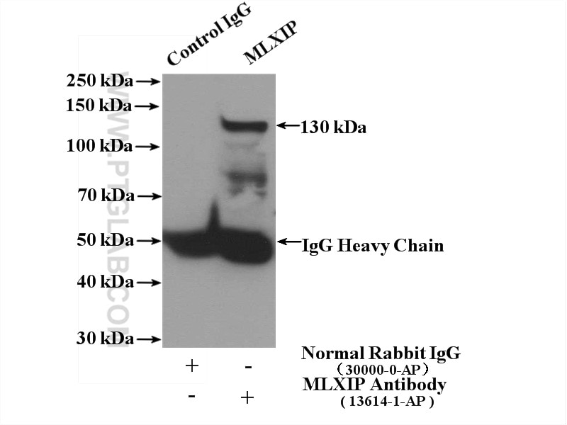 Immunoprecipitation (IP) experiment of K-562 cells using MLXIP Polyclonal antibody (13614-1-AP)