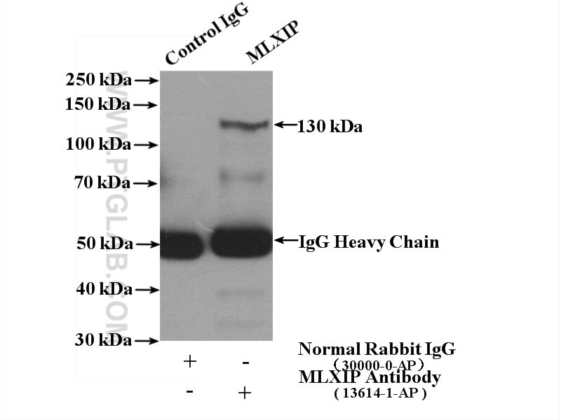 Immunoprecipitation (IP) experiment of K-562 cells using MLXIP Polyclonal antibody (13614-1-AP)