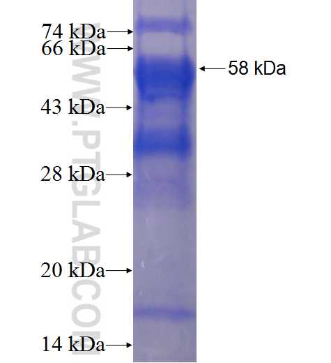 MLXIP fusion protein Ag4519 SDS-PAGE