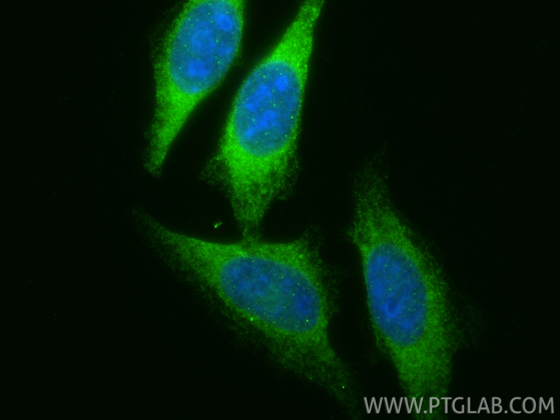 Immunofluorescence (IF) / fluorescent staining of HepG2 cells using MLXIPL Polyclonal antibody (13256-1-AP)