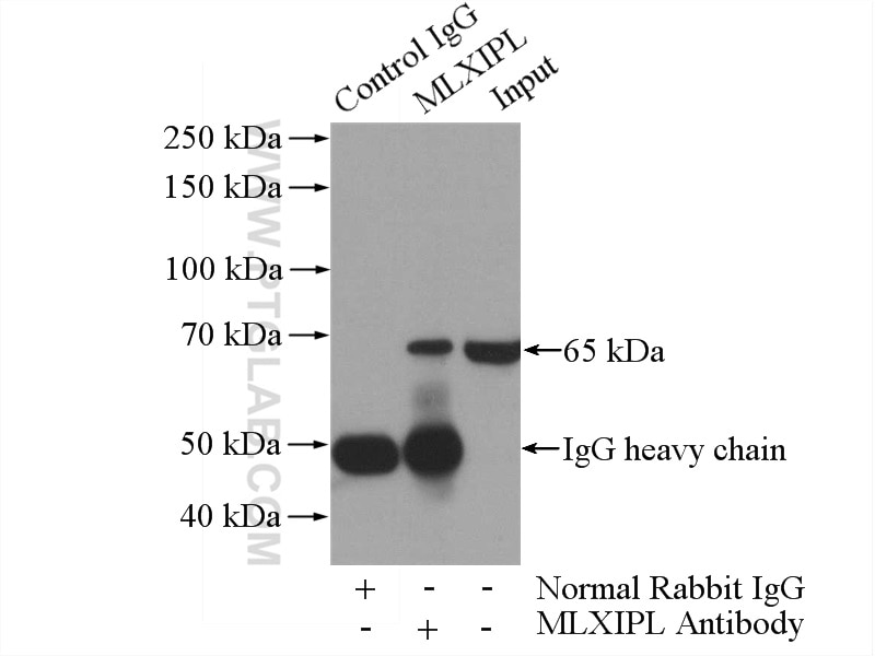 Immunoprecipitation (IP) experiment of HepG2 cells using MLXIPL Polyclonal antibody (13256-1-AP)