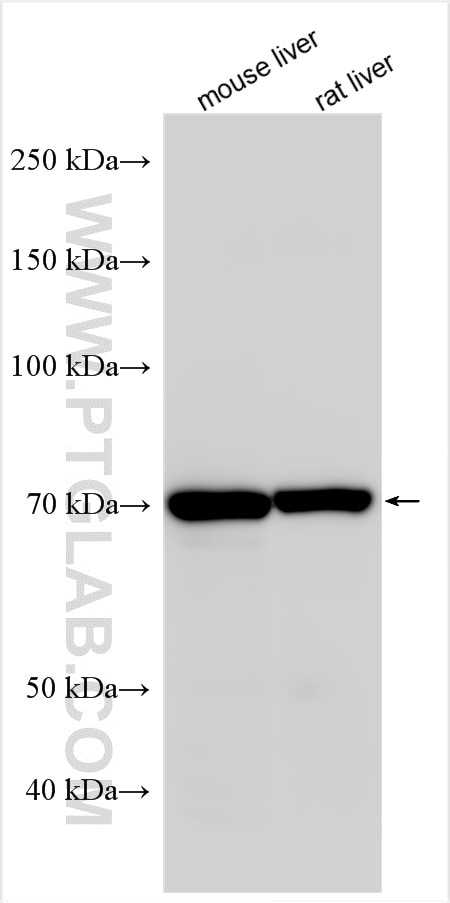 Western Blot (WB) analysis of various lysates using MLXIPL Polyclonal antibody (13256-1-AP)