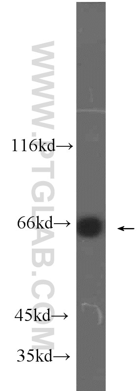 Western Blot (WB) analysis of human liver tissue using MLXIPL Polyclonal antibody (13256-1-AP)