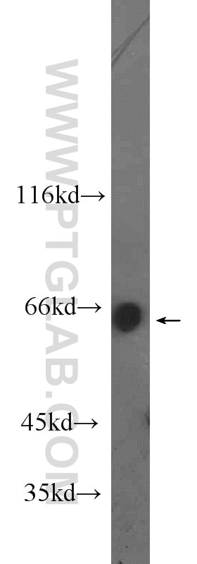 Western Blot (WB) analysis of HepG2 cells using MLXIPL Polyclonal antibody (13256-1-AP)