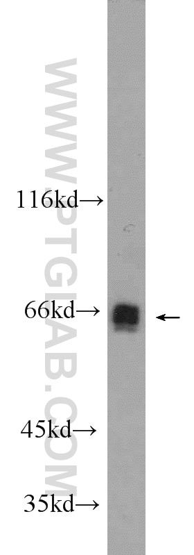 Western Blot (WB) analysis of HeLa cells using MLXIPL Polyclonal antibody (13256-1-AP)