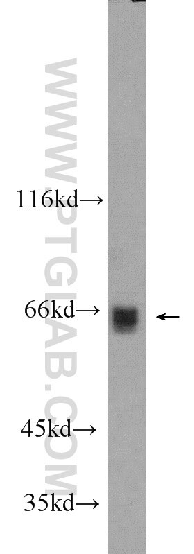 Western Blot (WB) analysis of HeLa cells using MLXIPL Polyclonal antibody (13256-1-AP)