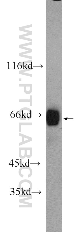 Western Blot (WB) analysis of HepG2 cells using MLXIPL Polyclonal antibody (13256-1-AP)