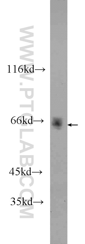 Western Blot (WB) analysis of HepG2 cells using MLXIPL Polyclonal antibody (13256-1-AP)