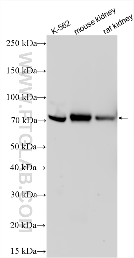 WB analysis using 33703-1-AP Western Blot (WB) analysis of various lysates using MLXIPL Polyclonal antibody (33703-1-AP)