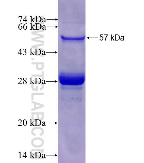MLXIPL fusion protein Ag3481 SDS-PAGE