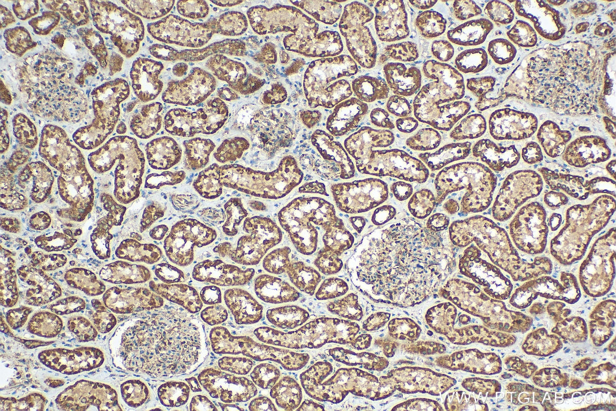 Immunohistochemistry (IHC) staining of human kidney tissue using MLYCD Polyclonal antibody (15265-1-AP)