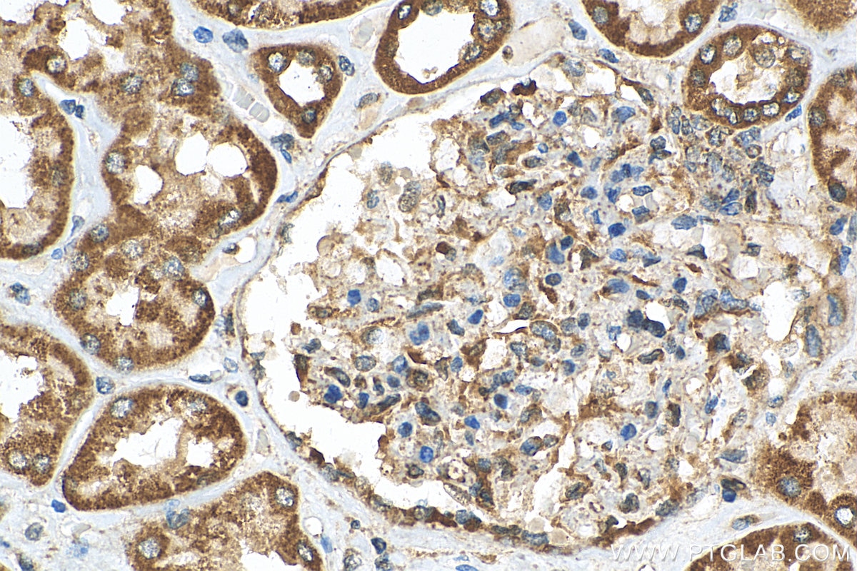 Immunohistochemistry (IHC) staining of human kidney tissue using MLYCD Polyclonal antibody (15265-1-AP)