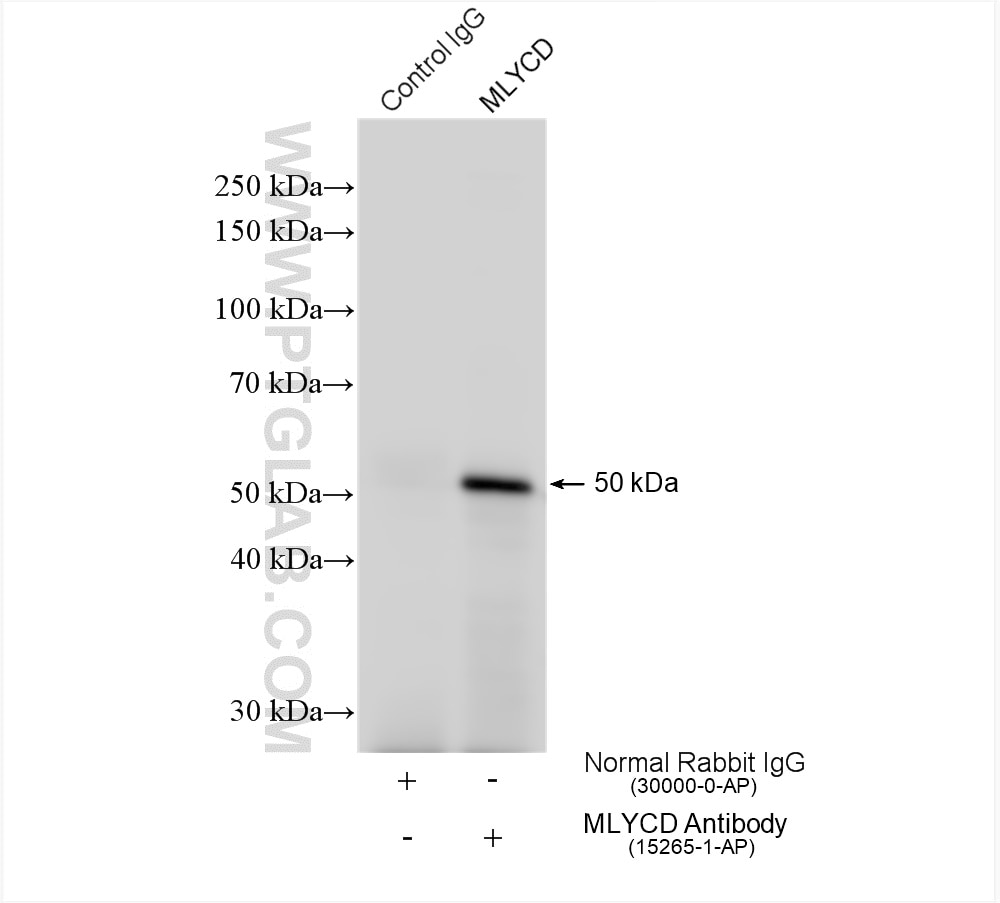 Immunoprecipitation (IP) experiment of mouse liver tissue using MLYCD Polyclonal antibody (15265-1-AP)