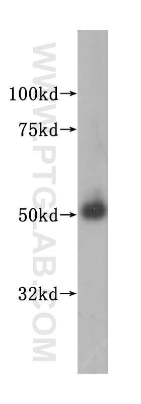 Western Blot (WB) analysis of human testis tissue using MLYCD Polyclonal antibody (15265-1-AP)