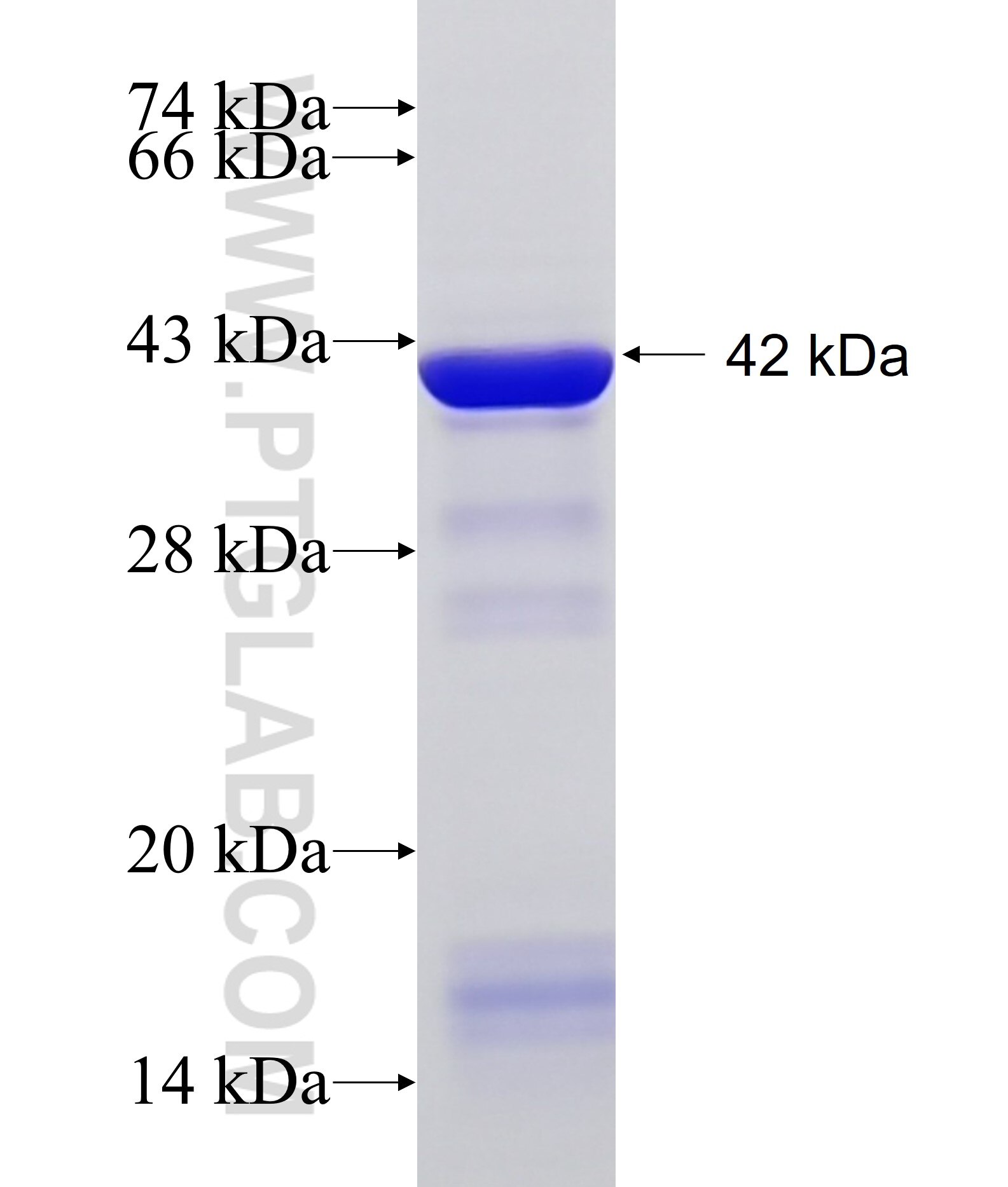 MLYCD fusion protein Ag18825 SDS-PAGE