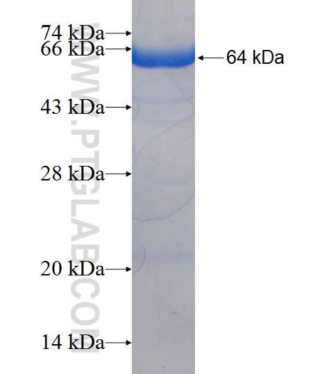 MLYCD fusion protein Ag7334 SDS-PAGE