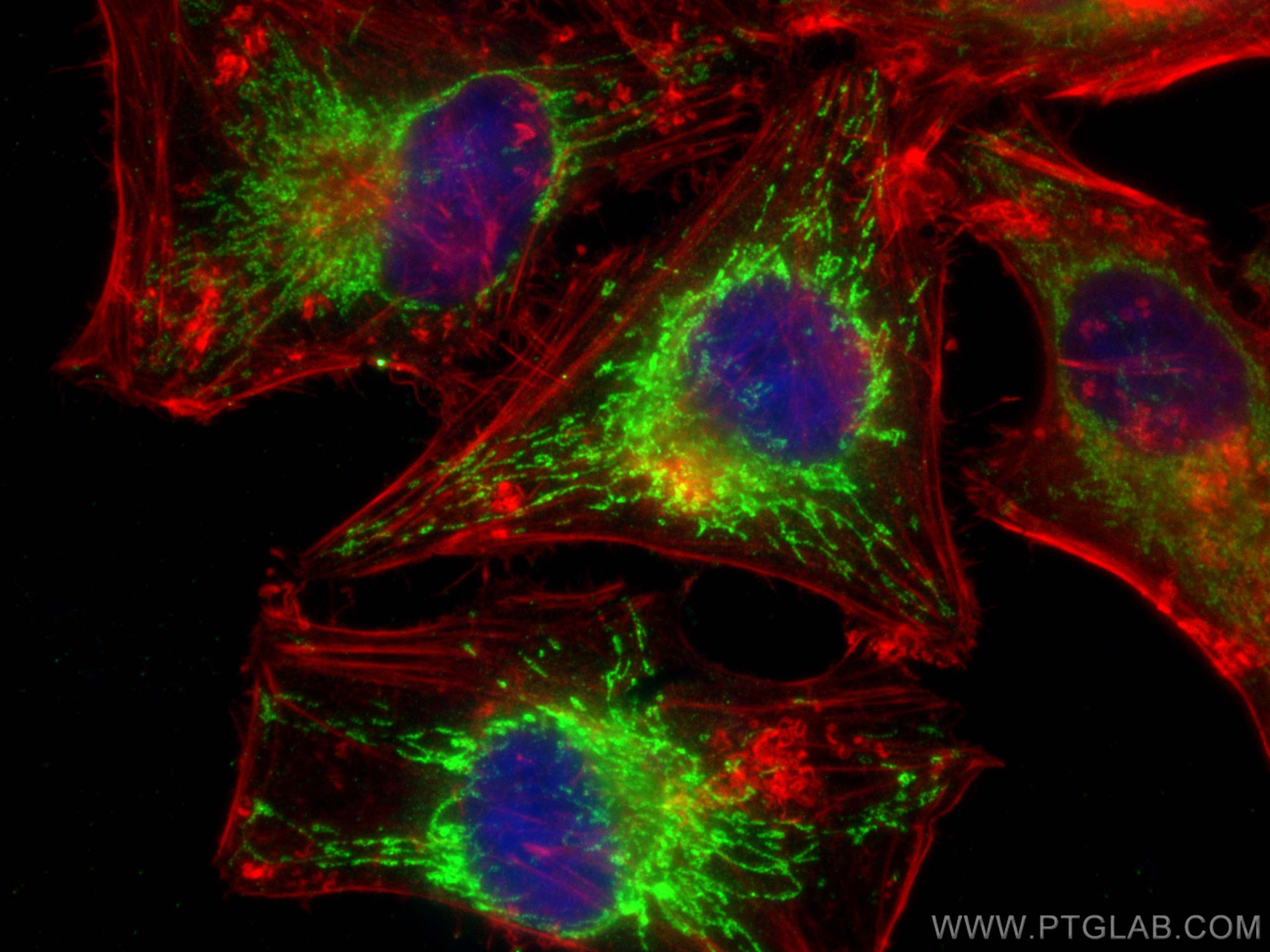 Immunofluorescence (IF) / fluorescent staining of HeLa cells using MMAB Polyclonal antibody (11137-1-AP)