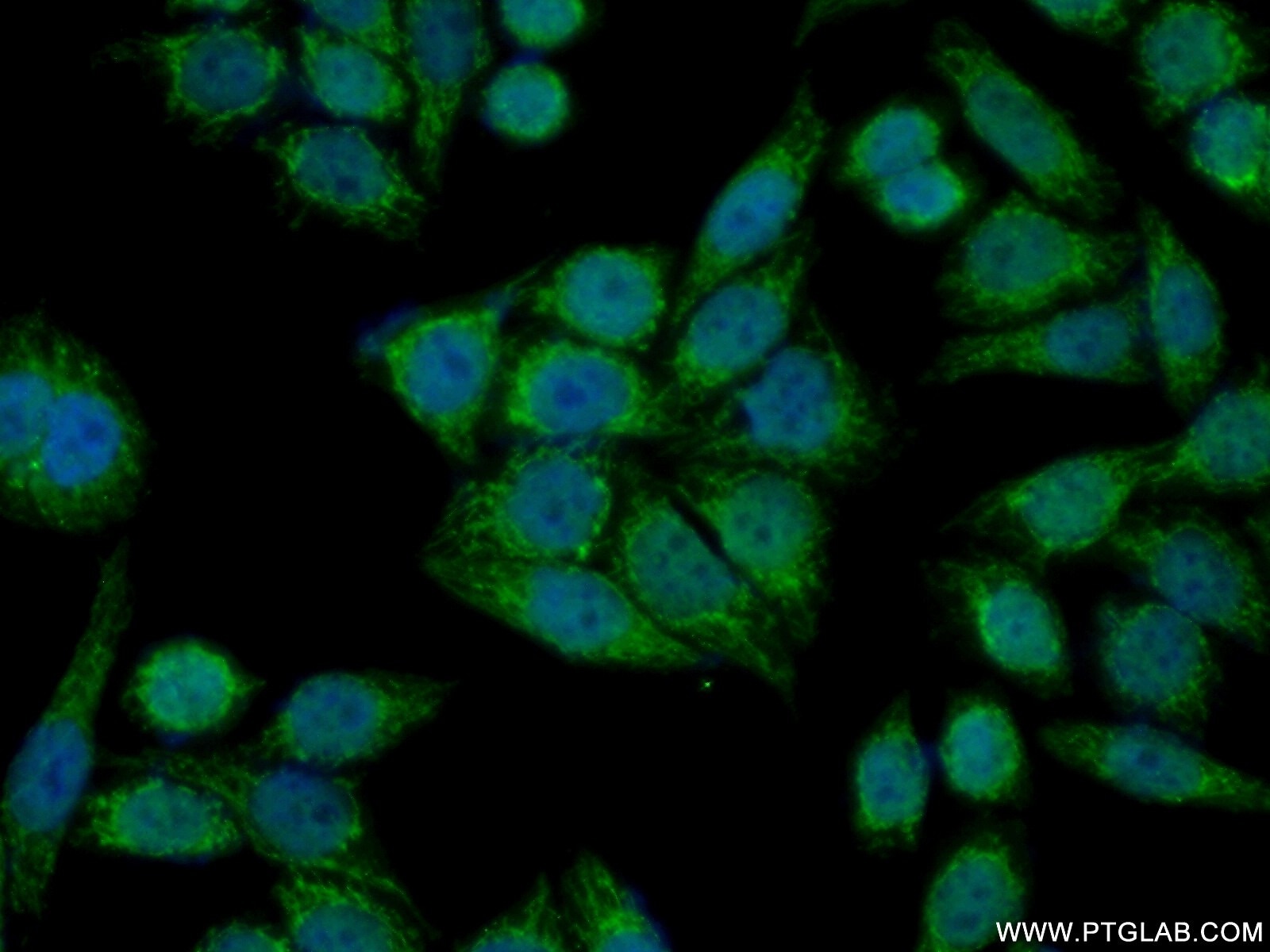 Immunofluorescence (IF) / fluorescent staining of HeLa cells using MMAB Polyclonal antibody (11137-1-AP)