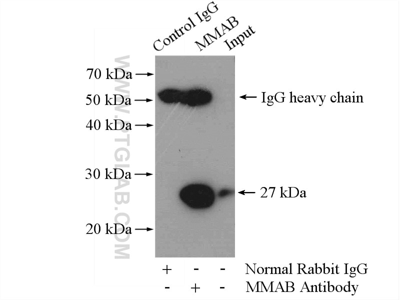 Immunoprecipitation (IP) experiment of HeLa cells using MMAB Polyclonal antibody (11137-1-AP)