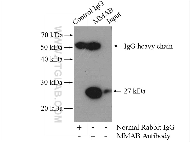 IP experiment of HeLa using 11137-1-AP