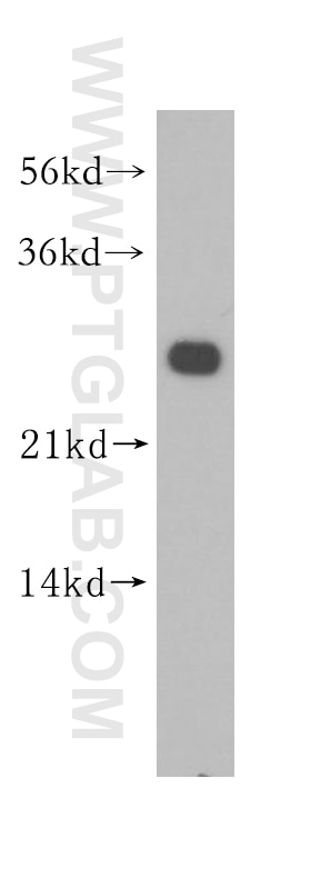 Western Blot (WB) analysis of HeLa cells using MMAB Polyclonal antibody (11137-1-AP)