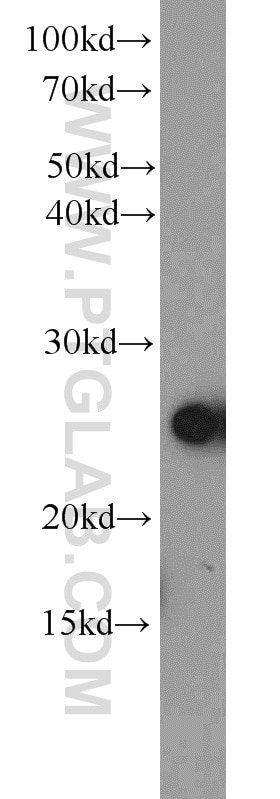 Western Blot (WB) analysis of L02 cells using MMAB Polyclonal antibody (11137-1-AP)