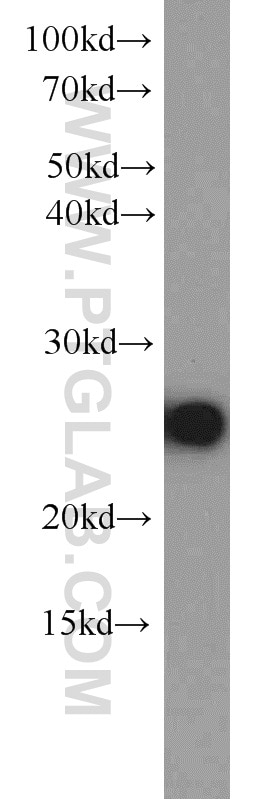 Western Blot (WB) analysis of L02 cells using MMAB Polyclonal antibody (11137-1-AP)