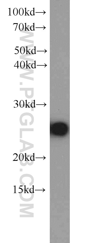 Western Blot (WB) analysis of L02 cells using MMAB Polyclonal antibody (11137-1-AP)