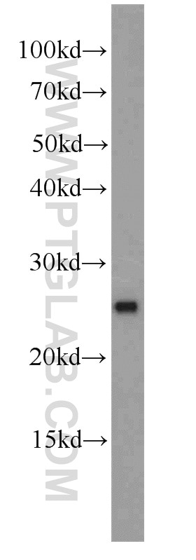 Western Blot (WB) analysis of HepG2 cells using MMAB Polyclonal antibody (11137-1-AP)