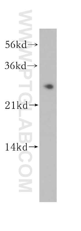 Western Blot (WB) analysis of BxPC-3 cells using MMAB Polyclonal antibody (11137-1-AP)