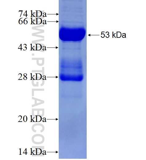 MMAB fusion protein Ag1602 SDS-PAGE