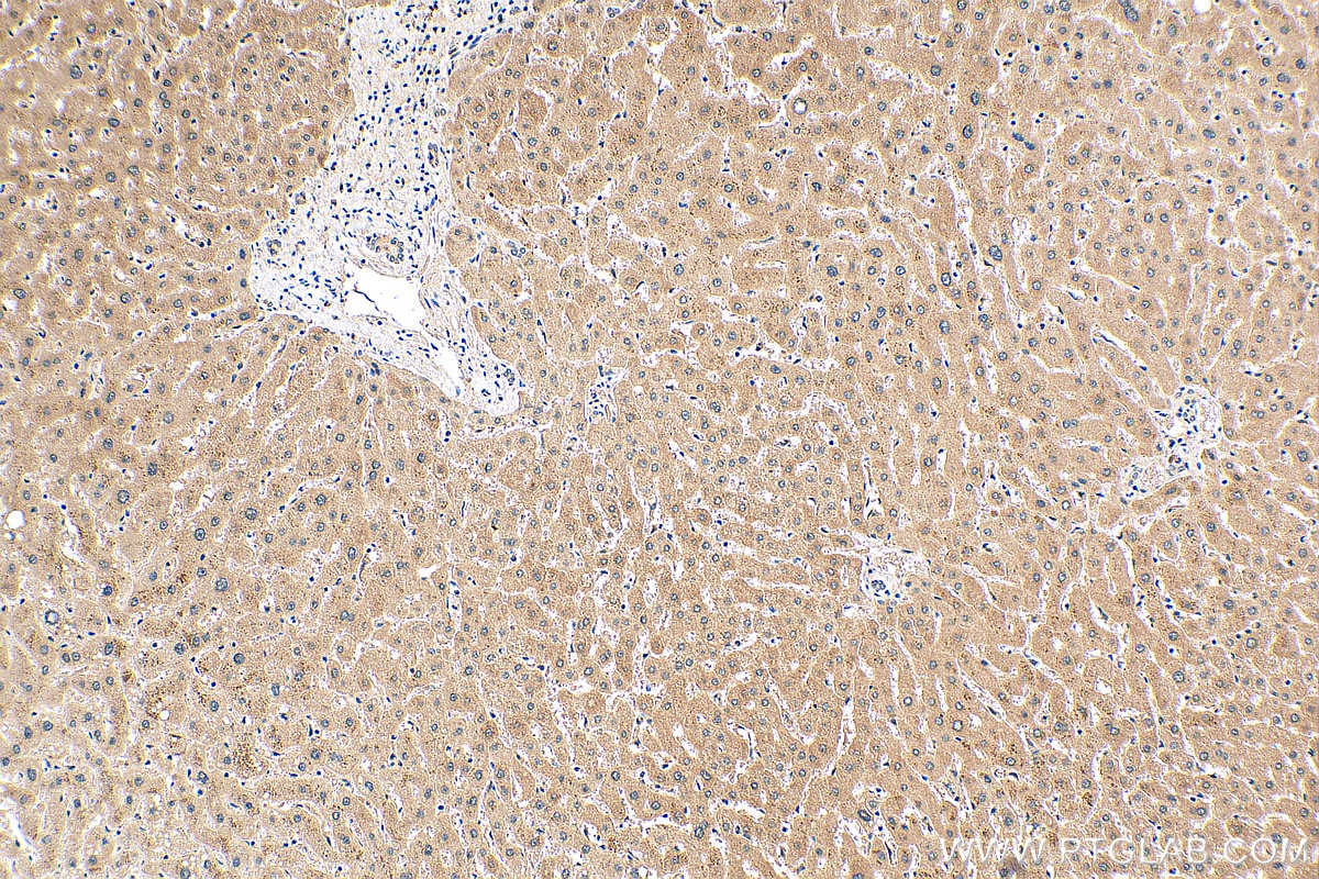 Immunohistochemistry (IHC) staining of human liver tissue using MMACHC Polyclonal antibody (21462-1-AP)