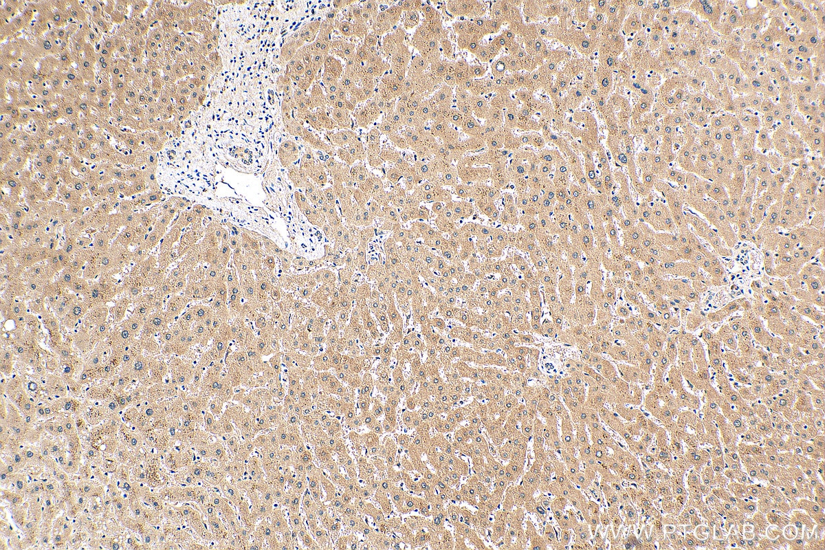 IHC staining of human liver using 21462-1-AP