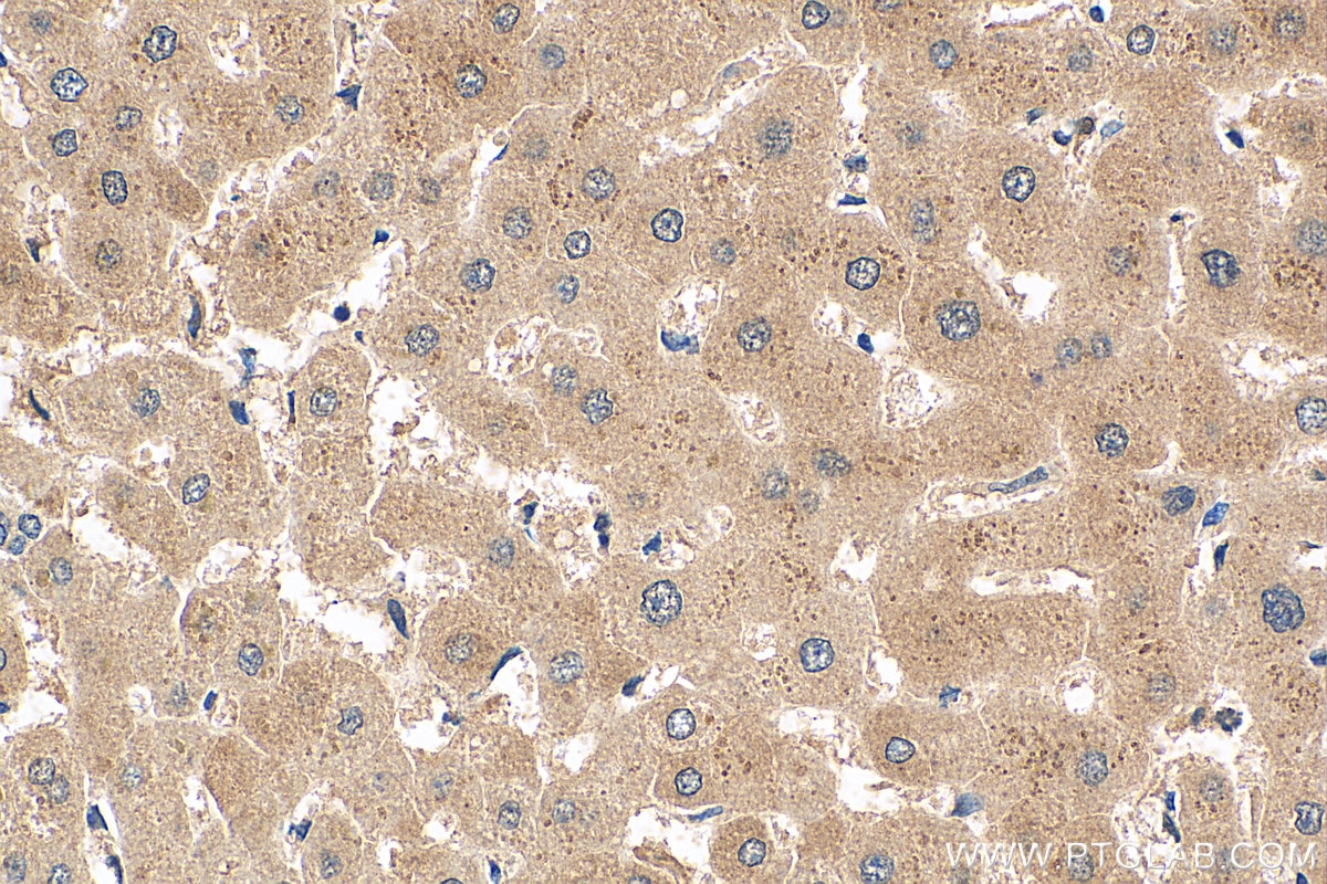 Immunohistochemistry (IHC) staining of human liver tissue using MMACHC Polyclonal antibody (21462-1-AP)