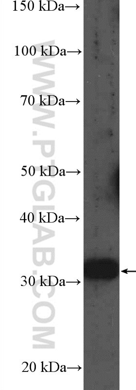 Western Blot (WB) analysis of Raji cells using MMACHC Polyclonal antibody (21462-1-AP)