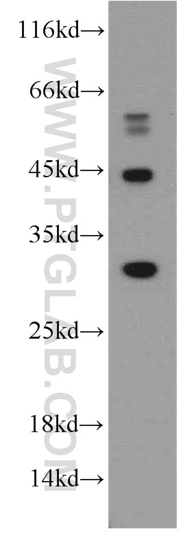 Western Blot (WB) analysis of HeLa cells using MMACHC Polyclonal antibody (21462-1-AP)
