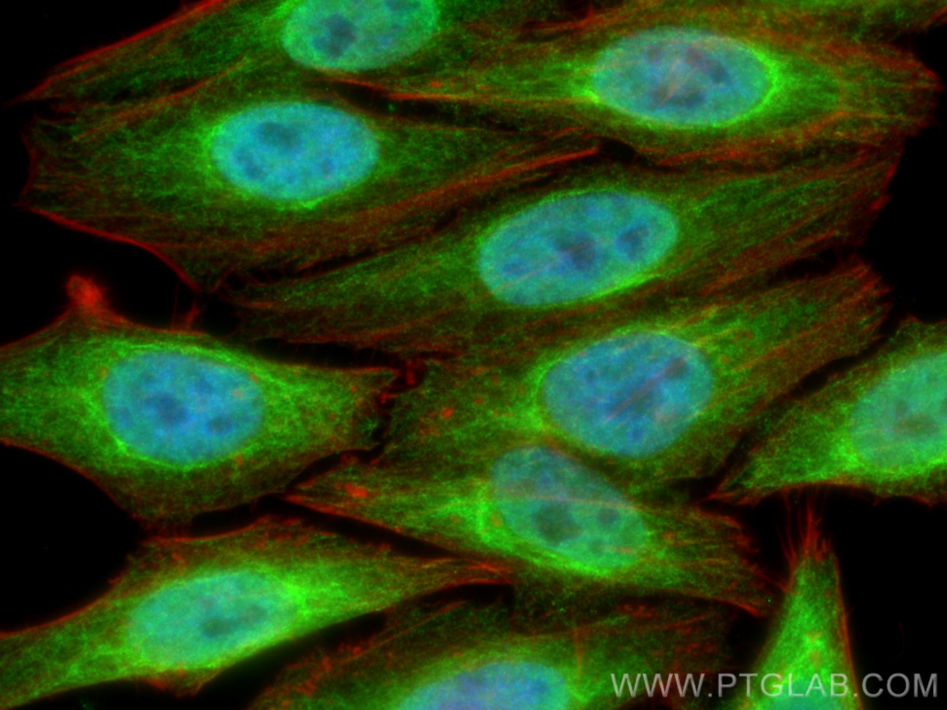 Immunofluorescence (IF) / fluorescent staining of HepG2 cells using MMACHC Monoclonal antibody (66609-1-Ig)