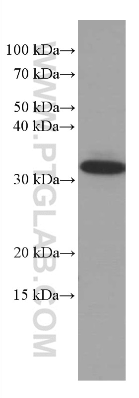 Western Blot (WB) analysis of HEK-293 cells using MMACHC Monoclonal antibody (66609-1-Ig)