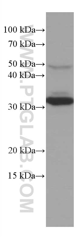 Western Blot (WB) analysis of HeLa cells using MMACHC Monoclonal antibody (66609-1-Ig)